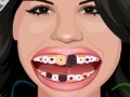 Spel Selena Gomez Perfect Teeth 