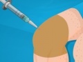 Spel Operate Now: Knee Surgery