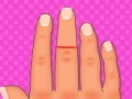 Spel Finger surgery