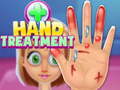 Spel Hand Treatment